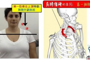 有些人膀子上有块硬石头却怎样都按不软看这儿