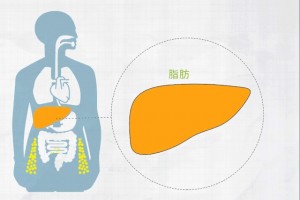 国内新研讨3个目标高瘦人也会得脂肪肝