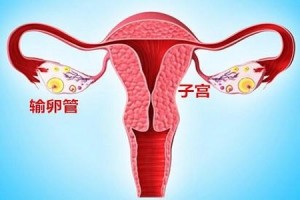 什么是输卵管阻塞会让女人患上不孕症吗