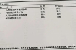 胺碘酮也搞不定的心律失常你会治疗吗